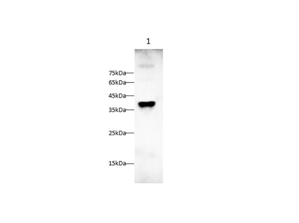 MCSF Polyclonal Antibody (AN006860L)