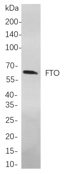 Recombinant FTO Monoclonal Antibody (AN300956L)