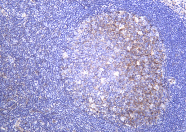Recombinant Integrin α5 Monoclonal Antibody (AN301258L)