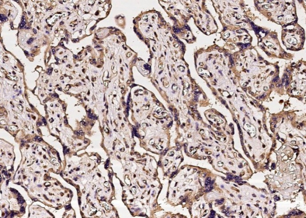 Recombinant Carbonic Anhydrase VB/CA5B Monoclonal Antibody (AN300121P)