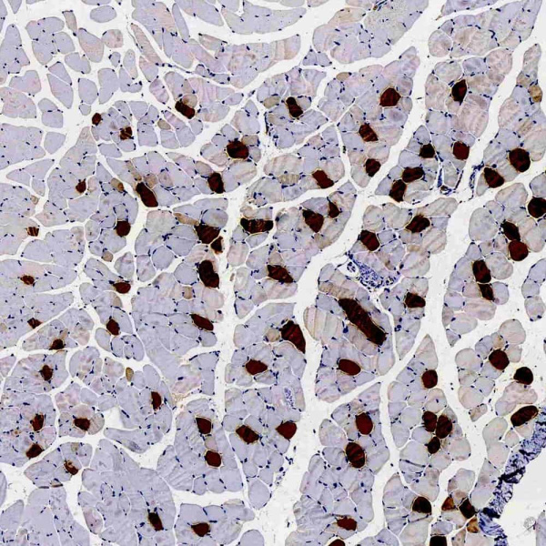 MYL2 Polyclonal Antibody (E-AB-70328)