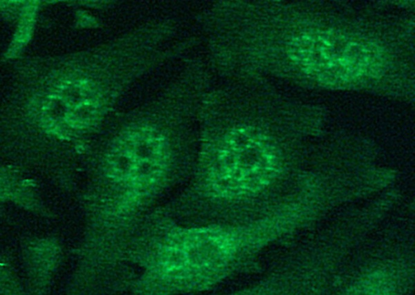 Recombinant HIF-1 alpha/HIF1A Monoclonal Antibody (AN300409P)