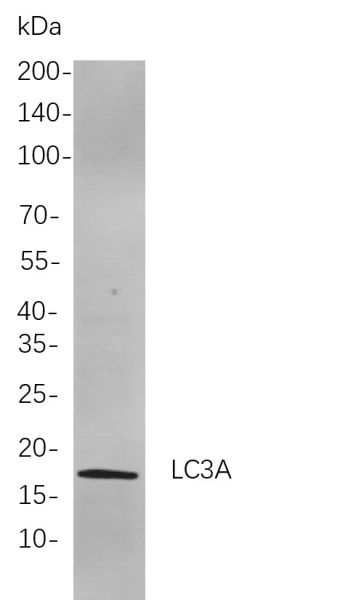 Recombinant LC3A Monoclonal Antibody (AN301015L)