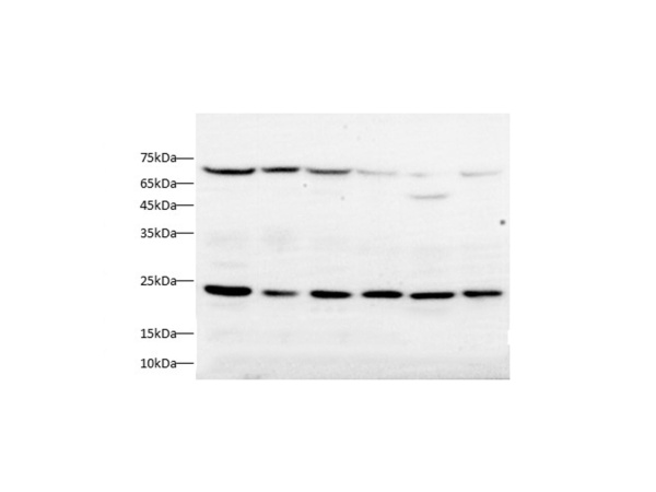TIMP-2/TIMP2 Polyclonal Antibody (D-AB-10444L)