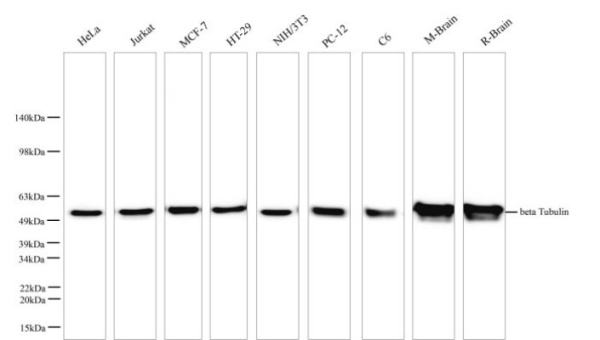 beta Tubulin Monoclonal Antibody (AN005310L)