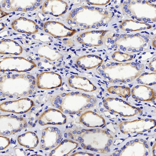 DICER1 Polyclonal Antibody (E-AB-70297)