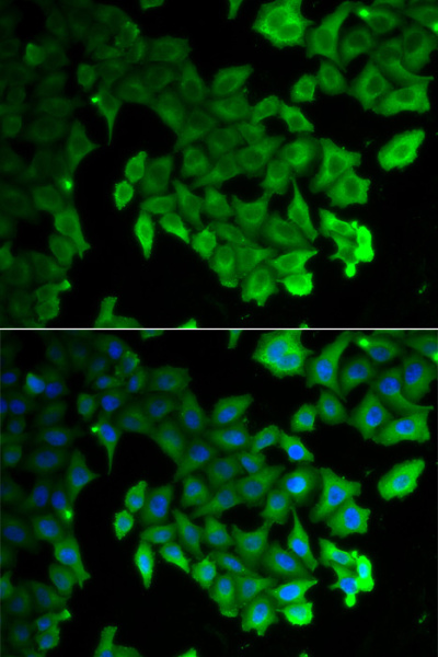 LC3A/LC3B Polyclonal Antibody (E-AB-61027)