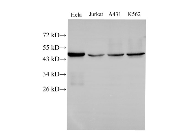 CK-18 Polyclonal Antibody (D-AB-10166L)