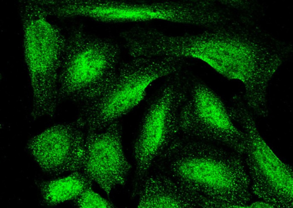ASF1B Monoclonal Antibody (AN200242P)