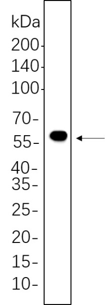 Recombinant DFNA5/GSDME Monoclonal Antibody (AN300798L)