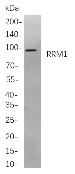 Recombinant RRM1 Monoclonal Antibody (AN300940L)