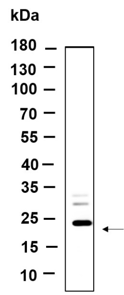 Recombinant LHFPL5 Monoclonal Antibody (AN301222L)