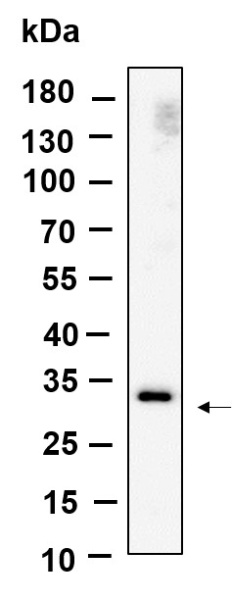 Recombinant Nogo B receptor Monoclonal Antibody (AN301238L)