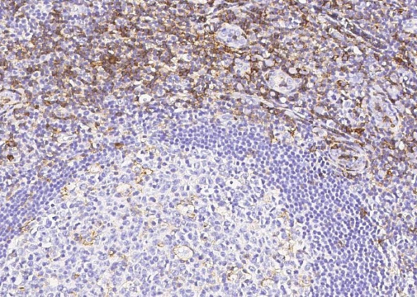 Recombinant PSGL-1/CD162/SELPLG Monoclonal Antibody (AN300442P)