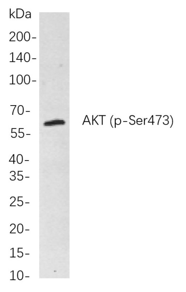 Recombinant Phospho-Akt (pan) (Ser473) Monoclonal Antibody (AN300915L)