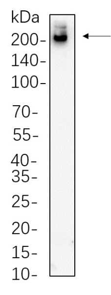 Recombinant Tuberin Monoclonal Antibody (AN300670L)