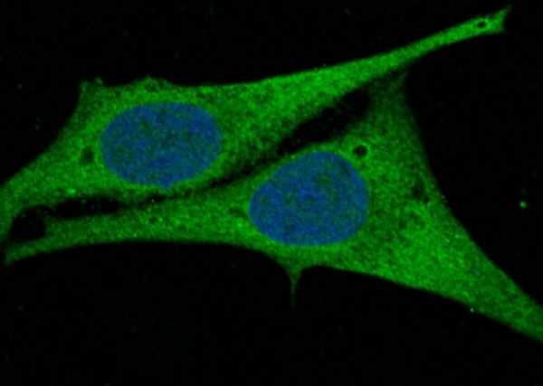 Recombinant AK2/Adenylate kinase 2 Monoclonal Antibody (AN300118P)