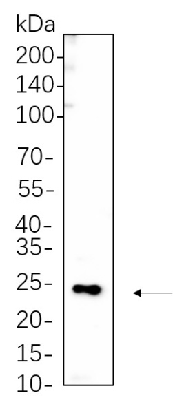 Recombinant Phospho-MYL9 (Thr18/Ser19) Monoclonal Antibody (AN301302L)