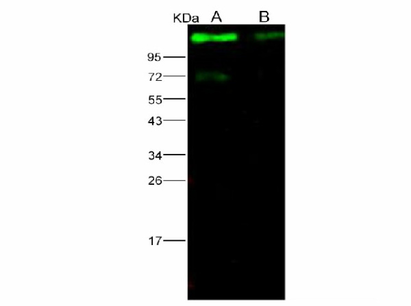 Anti-Ebola virus EBOV(Subtype Sudan, strain Gulu) Glycoprotein/GP1(mucin domain deleted) Monoclonal Antibody (E-AB-V1111)