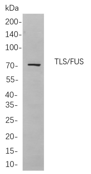 Recombinant TLS/FUS Monoclonal Antibody (AN301003L)
