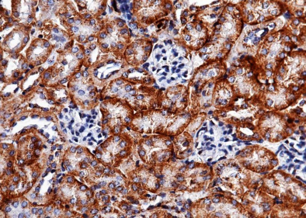 Recombinant Carbonic Anhydrase XII/Car12 Monoclonal Antibody (AN300457P)
