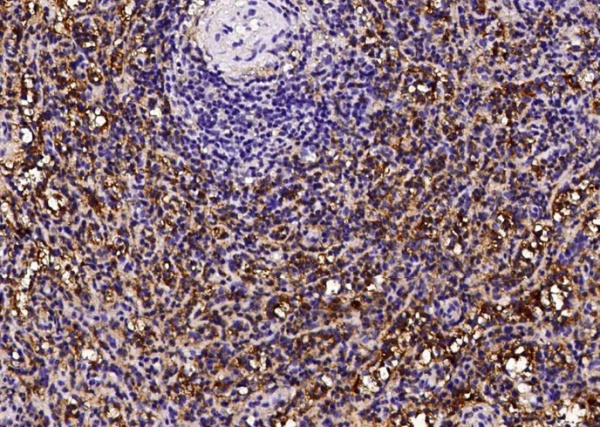 CD16a/FCGR3A Monoclonal Antibody (AN200175P)
