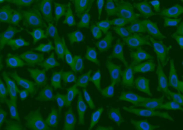 GPX4 Monoclonal Antibody (AN200085P)