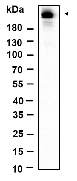 Recombinant Phospho-Rpb1 (Ser5) Monoclonal Antibody (AN301164L)