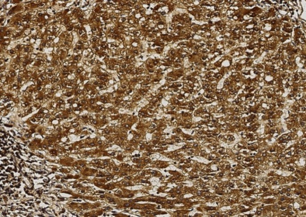 Recombinant AK2/Adenylate kinase 2 Monoclonal Antibody (AN300119P)