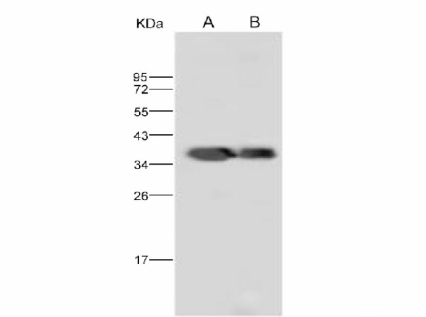 Anti-Dengue virus DENV-2(strain New Guinea C) NS5(methyltransferase domain) /Nonstructural protein 5 Polyclonal Antibody (E-AB-V1067)