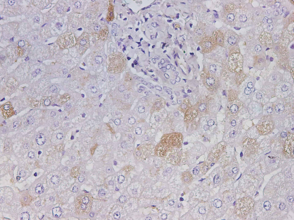 ALB Polyclonal Antibody (D-AB-10376L)