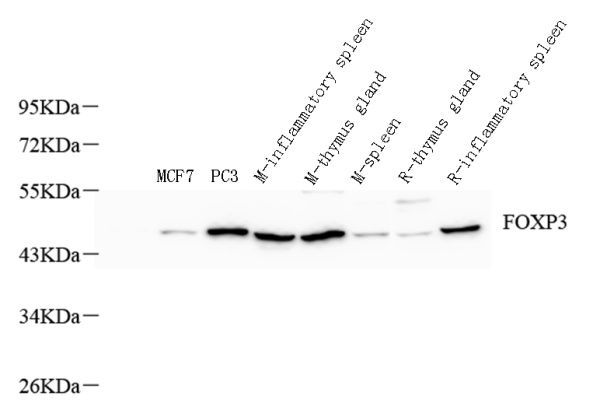 FOXP3 Polyclonal Antibody (E-AB-70038)