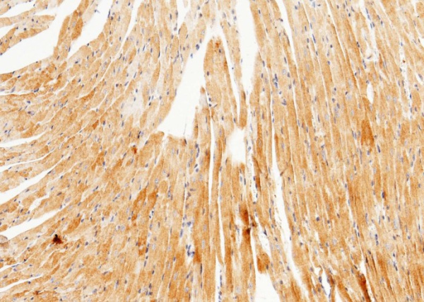 Recombinant UCHL3 Monoclonal Antibody (AN300546P)