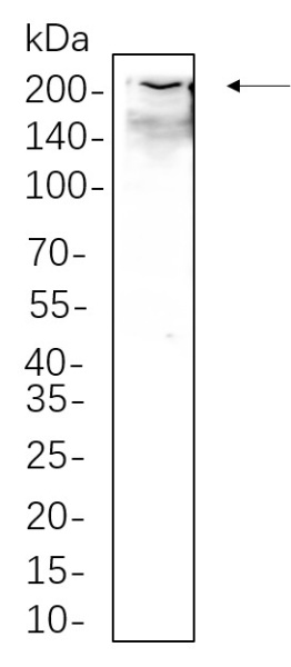 Recombinant Collagen I Monoclonal Antibody (AN301311L)