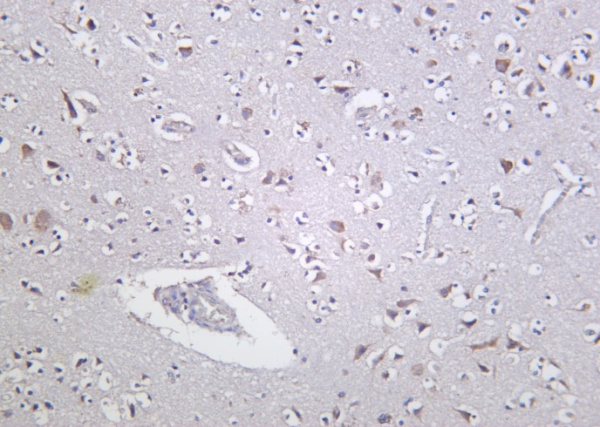 Recombinant PKD1 Monoclonal Antibody (AN301271L)