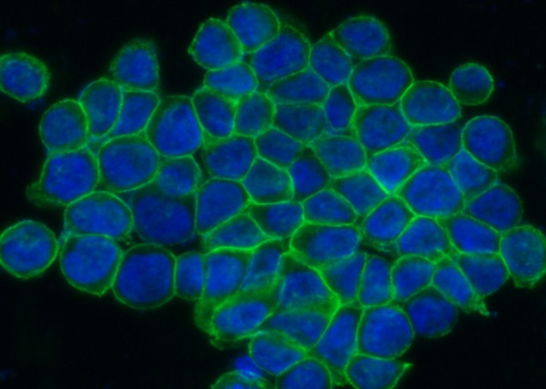 ENPP7 Monoclonal Antibody (AN200191P)