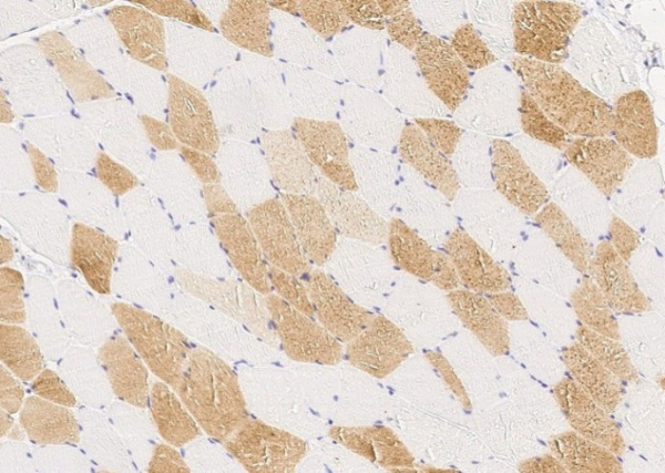 Recombinant PMVK/phosphomevalonate kinase Monoclonal Antibody (AN300281P)