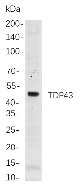 Recombinant TDP43 Monoclonal Antibody (AN300963L)