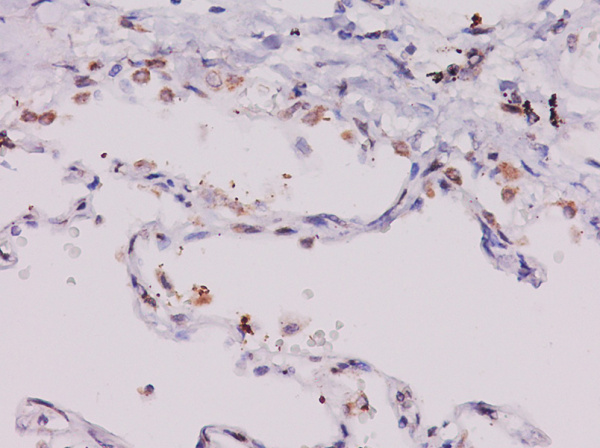 ECF/CCL11 Polyclonal Antibody (AN007190L)