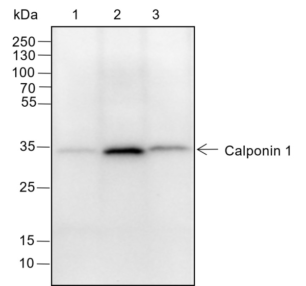 Recombinant Calponin 1 Monoclonal Antibody (AN301455L)