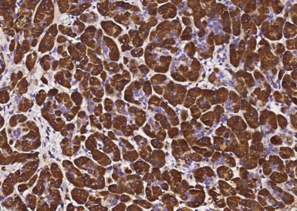 Recombinant PNLIP Monoclonal Antibody (AN300270P)