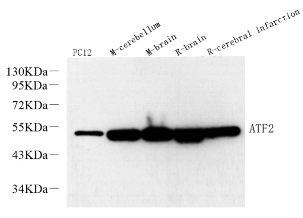 ATF2 Polyclonal Antibody (E-AB-70183)