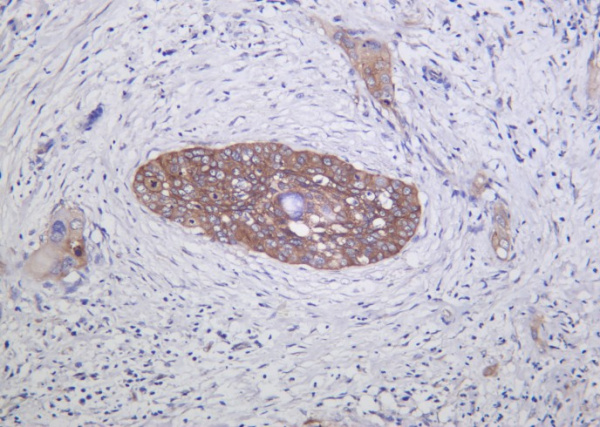 Recombinant Integrin α2 Monoclonal Antibody (AN301291L)