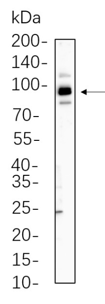 Recombinant STAT5b Monoclonal Antibody (AN300678L)