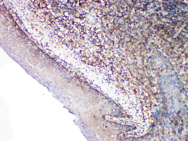 CD99 Monoclonal Antibody (ELAB6025-M)