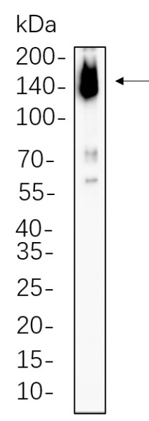 Recombinant ASK1 Monoclonal Antibody (AN300808L)