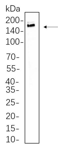 Recombinant IRS-1 Monoclonal Antibody (AN301322L)
