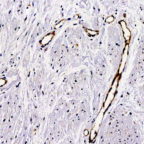 VWF Polyclonal Antibody (E-AB-70006)