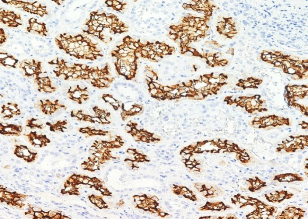 Recombinant ACE2 Monoclonal Antibody (AN300027P)