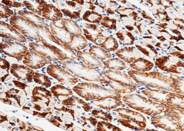 Recombinant CXADR Monoclonal Antibody (AN300458P)